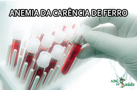 ANEMIA DA CARÊNCIA DE FERRO