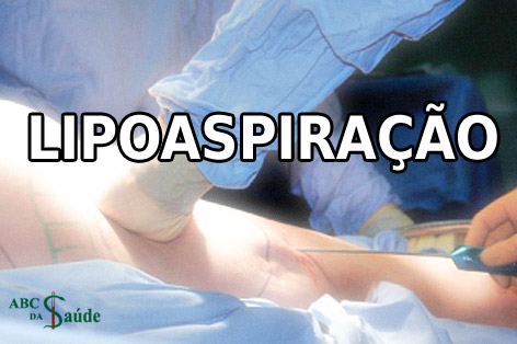 LIPOASPIRAÇÃO