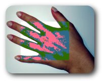 MICOSES SUPERFICIAIS