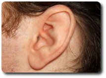 OTOPLASTIA - CIRURGIA PLASTICA NAS ORELHAS