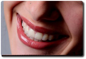 ORTODONTIA INVISÍVEL